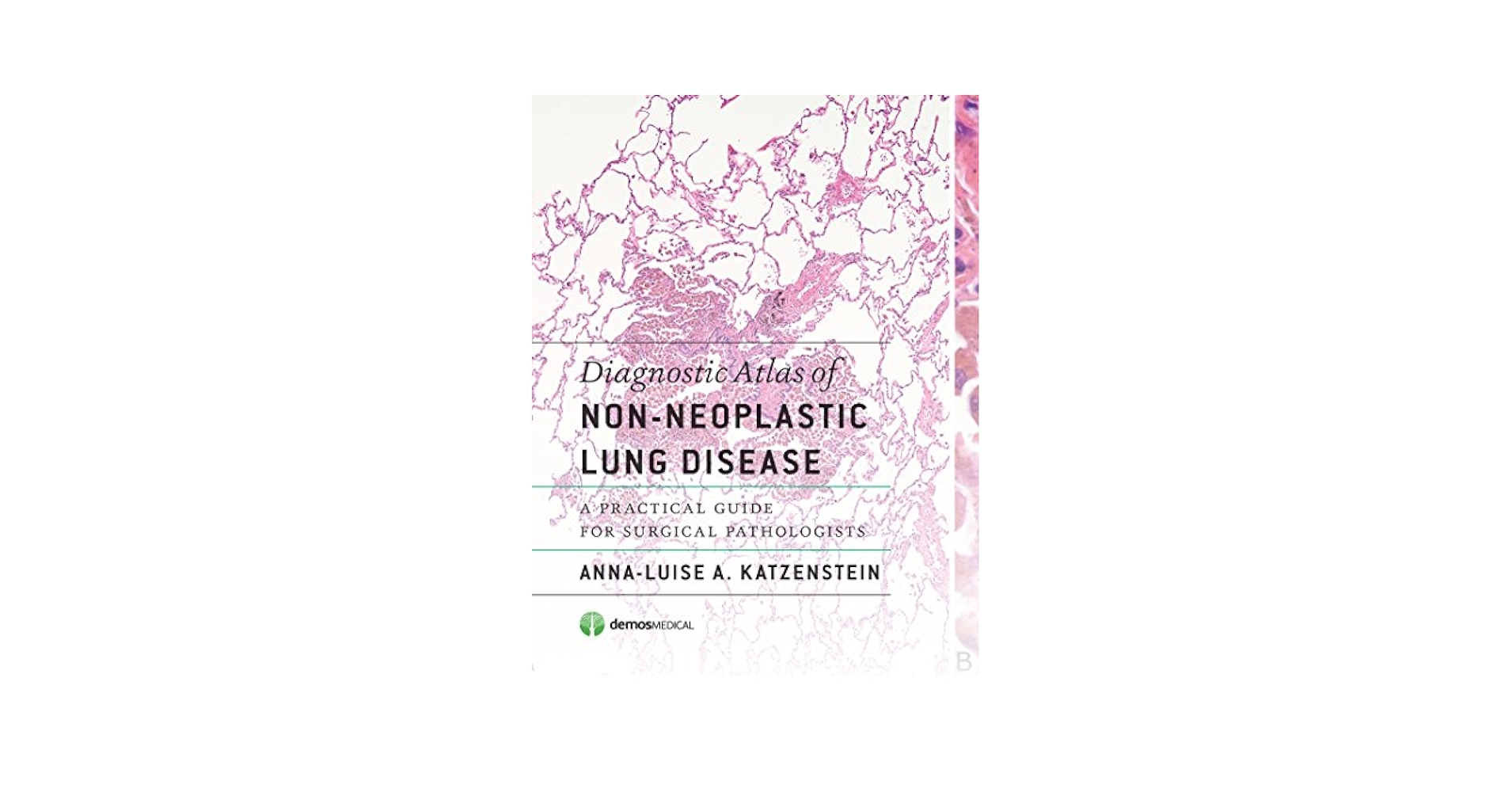 健康・医学 Diagnostic Atlas of Non-Neoplastic Lung Diagnostic Atlas of Non-Neoplastic Lung Disease: A Practical